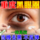 重度黑眼圈去除黑色素沉淀混合型淡化長(cháng)期眼周暗沉專(zhuān)用熬夜男女Y 一盒【快速去除】