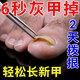 南京同仁堂灰指甲重度真菌感染增厚發(fā)黃脫甲亮甲治療灰指甲第1名正品抑菌藥 體驗裝