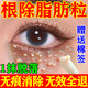 圣鑫堂脂肪粒去除神器眼周專(zhuān)用去小顆粒去除藥膏眼霜汗管瘤克星日本進(jìn)口 1盒【贈送棉簽 一抹當晚消除】 眼部眼睛下面小顆粒