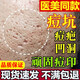 祛痘印淡化消除去痘痘和痘印痘坑修復(fù)男士凹洞填充再生黑色素沉淀 三盒【無校包退】買二送一