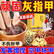 北京同仁堂灰指甲泡腳藥包真菌感染脫甲壞甲甲床分層增厚損傷腐臭傳染足浴包 一盒【體驗裝】