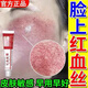 示博士敏感肌修復(fù)面霜臉部泛紅紅血絲修復(fù)角質(zhì)層薄增厚激素紅高原紅保濕 買2送1【修復(fù)敏感肌】輕度