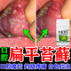 口腔扁平苔蘚專(zhuān)用藥】舌頭白斑嚴重口腔潰瘍口腔黏膜糜爛充血水泡腫痛嘴里長(cháng)白泡爛舌頭張嘴就疼 冬凌草片 2盒裝【舌頭白斑 喝水疼痛】