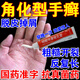治手癬藥】手癬真菌感染皮膚用的藥膏手脫皮用什么藥手癢起小水泡濕疹手蘚開(kāi)裂瘙癢揚子洲硝酸咪康唑乳膏 3盒【療程裝】水泡紅斑 有效止癢 肉眼可見(jiàn)