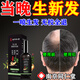 同仁堂同仁堂生發(fā)洗發(fā)水育發(fā)防脫養發(fā)藥男嚴重脫發(fā)頭發(fā)快速濃密增長(cháng)液 一盒裝【特效快速生發(fā)】
