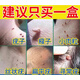 脖子上長的小肉粒疙瘩藥祛腋下猴子去除膏脖子上長的小肉粒疙瘩點(diǎn)痦子肉痣 痣皮贅 一盒裝【買二送一丨買三送二】