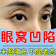 北京同仁堂眼窩凹陷修復(fù)眼貼填充改善眼皮松弛黑眼圈眼袋舒緩疲勞護(hù)眼貼 單盒裝