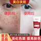 OIMG美白祛斑洗面奶男女通用淡化斑煙酰胺提亮膚色補水保濕神器潔面乳 賓諾祛斑潔面乳（1瓶）