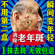 萊覽奧蓋祛斑霜美白淡化老年黃褐雀斑黑色素曬斑去祛斑男女士專用醫(yī)用正品 一盒裝【強(qiáng)力祛除】 老人斑臉部手背效果最好的產(chǎn)品