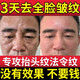 男士面霜緊致抗皺抗衰老淡化細(xì)紋抬頭紋消除神器去除專用額頭提拉 110g 2瓶【中度皺紋|淡化細(xì)紋】