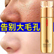 輕齡大師收縮毛孔精華液草莓鼻去黑頭毛孔粗大修復細致補水保濕男女護膚品 體驗裝1瓶【100ml/瓶】