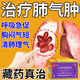 肺氣腫特新效藥進(jìn)口慢阻肺專用藥治一動(dòng)就大喘氣呼吸困難胸悶氣短上不來氣咳嗽痰多十五味龍膽花丸 2盒裝【胸悶氣促 呼吸困難】