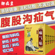 譚姥姥疝氣貼中老年人腹股溝疝嬰兒臍疝可搭專(zhuān)用特傚效疝氣藥膏內(nèi)消舒 三盒裝（實(shí)收5盒）