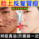 阿達帕林凝膠醫用祛痘消炎痤瘡專(zhuān)用青少年痤瘡硬疙瘩專(zhuān)用藥去痘痘和痘印痘痘修復消炎痘印藥膏皮膚用藥 2盒【臉上長(cháng)痘膿包粉刺】只需一抹 當場(chǎng)見(jiàn)效