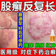 股癬大腿內側陰囊私處瘙癢專(zhuān)用藥 大腿根內測潮濕瘙癢腹股溝股癬體癬發(fā)黑花斑癬真菌感染噴霧 聯(lián)苯芐唑溶液 1瓶裝【專(zhuān)治股癬】國藥準字 當日發(fā)貨