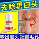 佰束去黑頭泥膜棒深層清潔毛孔垃圾除角質(zhì)白頭粉刺鼻貼收縮式撕拉面膜 40g 1瓶【黑頭/閉口/粉刺一掃光】
