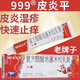 999復(fù)方醋酸地塞米松乳膏20g皮膚瘙癢真菌感染神經(jīng)性溢脂性皮炎專用特效膏藥瘙癢私處男女濕疹膏止癢 1盒裝三九九九999皮炎平軟乳膏