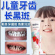 牙菌斑牙膏兒童牙齒美白神器減少牙垢牙漬牙黃牙齒黑斑益生菌牙膏 【買(mǎi)2送1】?jì)和毡緦?zhuān)研升級版