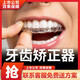 蓉爾F牙齒矯正器隱形牙套正畸齙牙縫透明成人兒童定制矯正神器矯治器 上下牙一期+矯正綜合方案服務(wù)