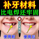 進口級納米樹脂補牙材料自己在家堵牙洞修復牙齒斷牙蛀牙填充神器 可補（9-12顆）有工具