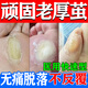 去腳底老繭去硬皮腳后跟角質(zhì)增生修腳底老繭去硬皮修腳神器腳底老繭去除腳上老繭皮潤膏皮膚用藥水楊酸軟膏 一盒裝【軟化角質(zhì) 去死皮】修腳底老繭去硬皮修腳神器
