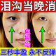 淚溝填充神器修復法令紋眼窩臉部凹陷液去除眼袋黑眼圈魚(yú)尾紋精華 單盒裝