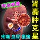 腎囊腫中藥貼腹部疼痛調(diào)理腰部腫塊腰疼血尿蛋白尿腎臟虛弱多囊腎積水腎虛虧益腎貼消除囊腫腎炎非藥中草貼Y 單盒裝【正品】