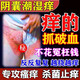 苗達(dá)靈陰囊瘙癢濕 疹男女專(zhuān)用去看根皮膚瘙癢特用效私處潮濕毛囊止癢膏 一瓶裝【明顯型】