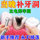 奕康本草補(bǔ)牙齒神器材料永久自己在家補(bǔ)牙材料永久醫(yī)用修復(fù)膠樹脂日本進(jìn)口 豪華版【三甲醫(yī)院同款】全套工具