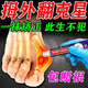 嚴重拇外翻矯正神器大腳趾外翻關(guān)節(jié)痛拇囊炎拇指外翻大腳骨專用膏 【1盒】拇外翻乳膏