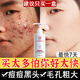 同仁堂氨基酸洗面奶控油祛痘除螨蟲(chóng)去黑頭縮毛孔洗面奶男深層清潔