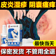 同仁堂濕疹止癢皮膚瘙癢皮炎專(zhuān)用陰囊潮濕肛門(mén)大腿內側私處止癢25+5ml 