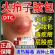 清熱拔解毒膏火癤子膿包疙瘩皮脂腺囊腫特新效期藥火癤子消炎藥專用藥身上屁股腿胳膊硬塊消腫止痛龍珠軟膏 1盒裝【火癤子 】國藥準字