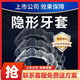 蓉爾F牙齒矯正器隱形牙套成人正畸糾正矯治器兒童齙牙牙縫地包天透明 單邊一期+矯正綜合方案服務(wù)