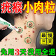 百易方去i疣體扁平疣絲狀疣專用瘊子猴子(非藥膏)脫落膏hpv祛疣神器凝膠 一盒【除疣凝膠】 頸部疣瘊靈去除脖子小肉粒尤