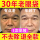 玖美堂眼袋去除神器男士專用眼霜膜眼袋提拉緊致抗皺淡化黑眼圈淡化細(xì)紋 類蛇毒眼霜【單盒體驗(yàn)裝】