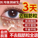 脂肪粒去除神器眼部眼角周油脂粒汗管瘤專用眼霜去粉刺閉口克星 30g 1支裝（體驗裝）