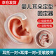 耳朵矯正器嬰兒新生兒耳廓矯正器寶寶耳朵定型矯正器矯正貼糾正 耳托一對+耳撐一對+壓敏膠帶 【調整塑型 適配性強】