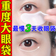 碧素堂眼袋貼去眼袋嚴(yán)重中老年專(zhuān)用去眼袋男女士專(zhuān)用眼霜祛眼袋去除神器 特效：1盒裝【淡化眼袋】