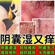 苗達(dá)靈陰囊潮濕瘙癢濕 疹肛門大腿內(nèi)側(cè)皮膚癢私處下面癢去 根專用止癢膏 見效快【 一瓶裝 】