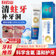 白云山蛀牙洞修i復(fù)齲齒牙膏爛牙蟲牙洞牙修復(fù)牙洞清理補(bǔ)牙含氟兒童牙痛 蛀牙洞修i復(fù)齲齒含氟 牙膏補(bǔ)洞修復(fù)劑【一支裝】