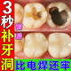 補(bǔ)牙洞齒神器材料永久自己在家補(bǔ)牙樹脂補(bǔ)牙齒修復(fù)凝膠潔離劑醫(yī)用 一盒【體驗(yàn)裝】補(bǔ)5-8顆牙