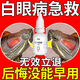 YEE烏龜藥土霉素治療白眼病草龜南石腐皮爛甲草龜巴西龜肺炎浮水腸胃 一瓶白眼滴眼液
