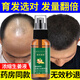 無(wú)品牌中年脫發(fā)禿頂熬夜掉發(fā)鬼剃頭頭發(fā)稀疏男女通用生姜生發(fā)液洗發(fā)水 拍2發(fā)3瓶【周期裝】增發(fā)神器
