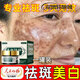 九朵運云祛斑霜淡化斑點皺紋黃褐斑老年斑雀斑色斑美白去黃 一罐裝 體驗裝 【官方直售 美白】