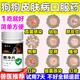 狗狗皮膚病專用藥口服片栗子堂真菌細(xì)菌感染皮炎濕疹瘙癢紅腫脫毛 單瓶裝【快速見效】