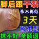 腳裂膏腳后跟干裂開(kāi)裂真菌感染手足干裂脫皮膏龜裂腳裂口干燥正品 100g 1瓶 【手腳干裂專(zhuān)用】