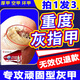 南京同仁堂灰指甲100%特殊效專用灰甲凈灰甲套裝液體35g*3