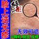 修正逆光疹修復(fù)皮膚屏障額頭小顆粒痘痘臉上長疙瘩閉口粉刺堵塞藥膏 單盒【體驗(yàn)裝】