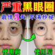 歐誘黑眼圈重度去除男女士熬夜去黑色素淡化細紋提拉緊致眼貼眼霜神器 1瓶【緩解眼部疲勞】